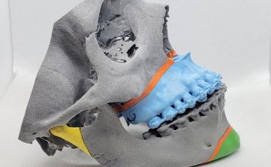 手术3D印刷在医院的作用新利18官方