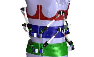 机器人脊柱外骨骼可以帮助治疗畸形