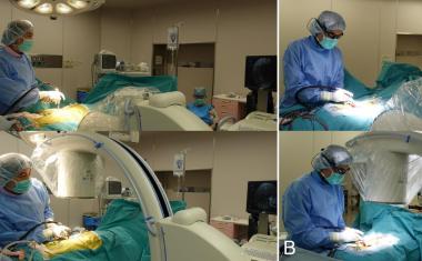 智能眼镜在手术过程中提供透视指导