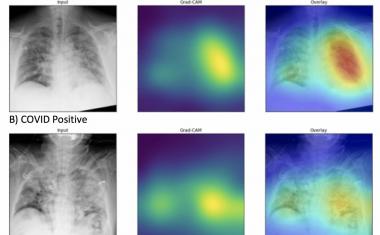 AI准确检测到胸部X射线上的Covid-19