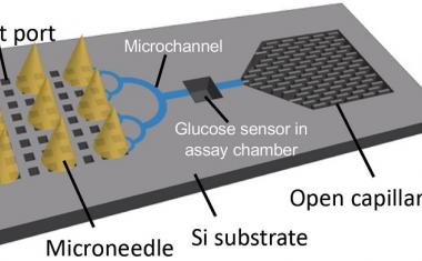 Microneedles: Nano-sized, huge impact