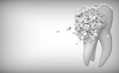 新利18官方牙科设备中的3D印染树脂可能有毒