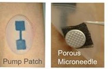 微针贴片提供药物和获取检测样品