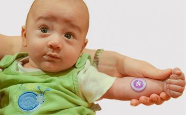 Sticker detects cystic fibrosis in newborn's sweat