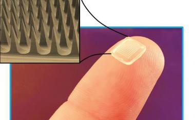 Microneedles for painless drug delivery
