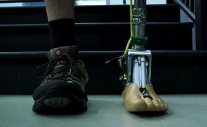 “智能”假肢脚踝可以适应粗糙的地形