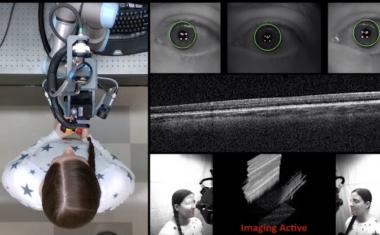 机器人扫描仪可以自动对眼睛进行诊断成像