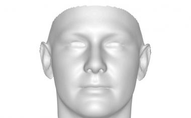 新的3D面部扫描将遗传线索与自闭症