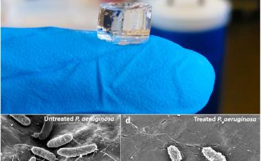 Hydrogel fights drug-resistant bacteria