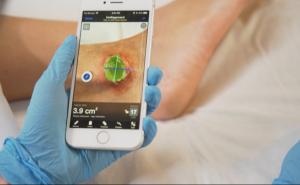 快速皮肤和伤口:应用程序提供触摸测量