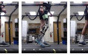 人工智能加快了机器人假肢的“调整”