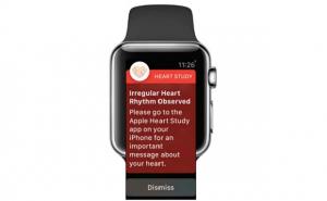 更新苹果心脏研究:可穿戴设备可以检测aFib