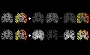 通过一次脑部扫描，人工智能获得了更多信息