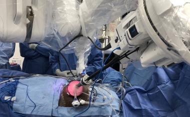 世界上第一个机器人单端口肾移植