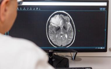 人工智能可以帮助脑癌患者避免活检