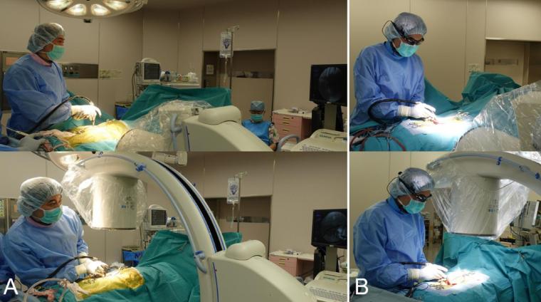 A:外科医生转开头部查看标准的透视显示器。