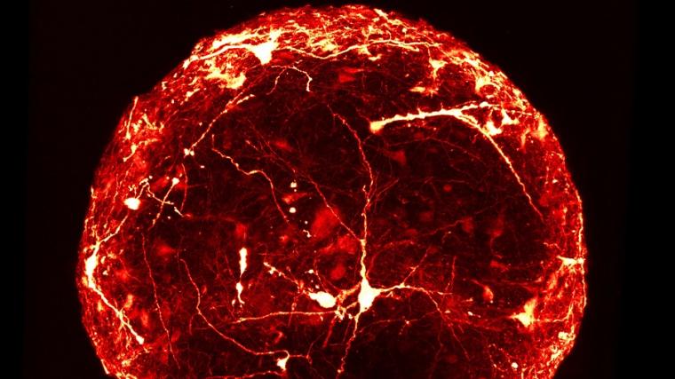 一个7个月大的3D迷你大脑成像与共聚焦显微镜显示…