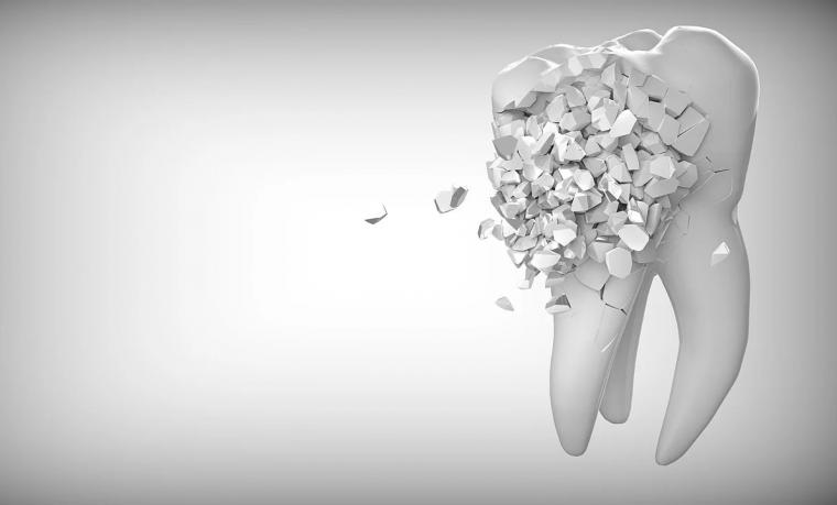 3D可打印树脂，例如牙科应用中使用的树脂，销售如......