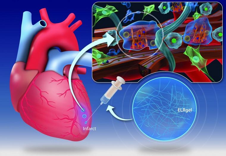 心脏和注射水凝胶的图表。
