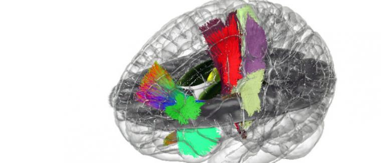 人类大脑的全息图像。