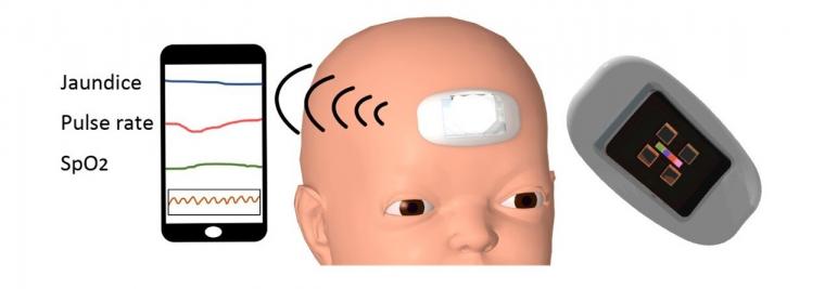 新生儿黄疸和生命体征可穿戴式检测装置示意图。