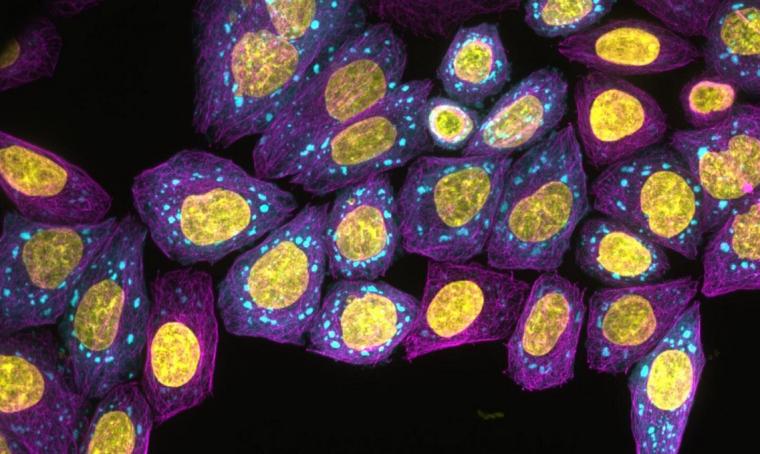 荧光显微镜图像的蛋白质缩合物形成内部生活…