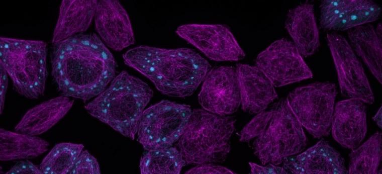 荧光显微镜下蛋白质缩合物在活细胞内形成的图像。