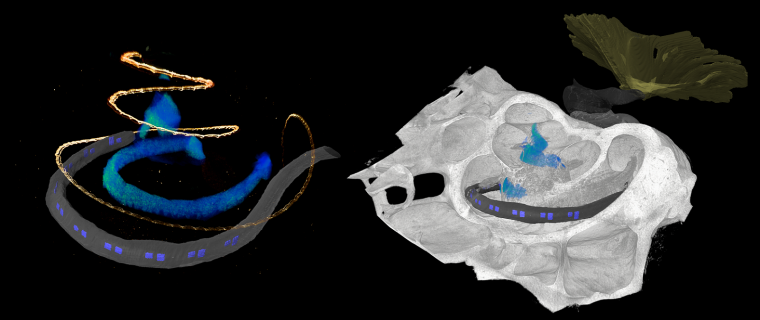 左图:光学led人工耳蜗的3D显微图像(蓝色led…