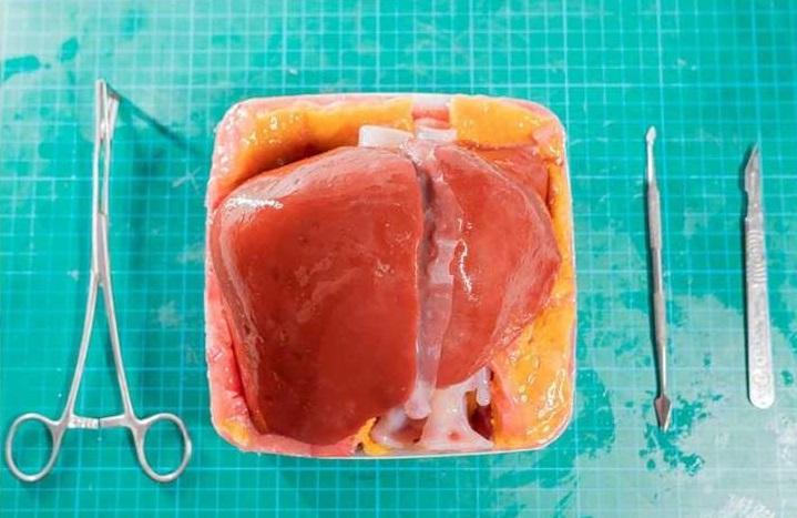 3d打印的肝脏模型。