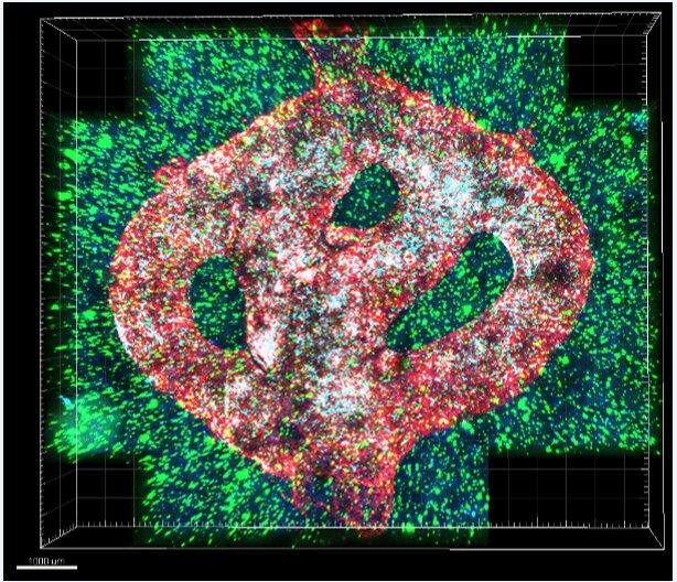 3d生物打印胶质母细胞瘤模型显微镜图像。打印的血……＂>
        <figcaption>
         <div class=