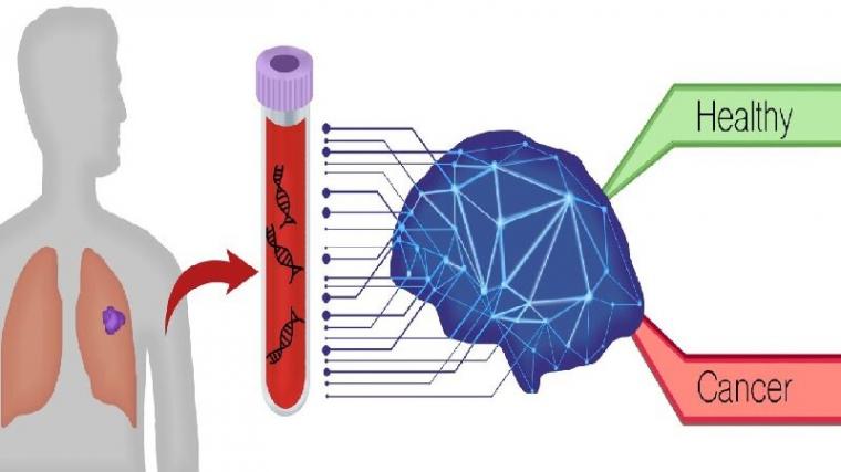 DELFI血液检测使用人工智能检测肺癌