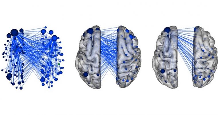 研究揭示了大脑中枢(点)和连接(线)可以预测……