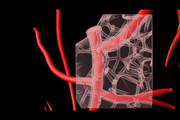 研究人员已经开发出一种3D生物打印胶原蛋白的技术，使他们可以…