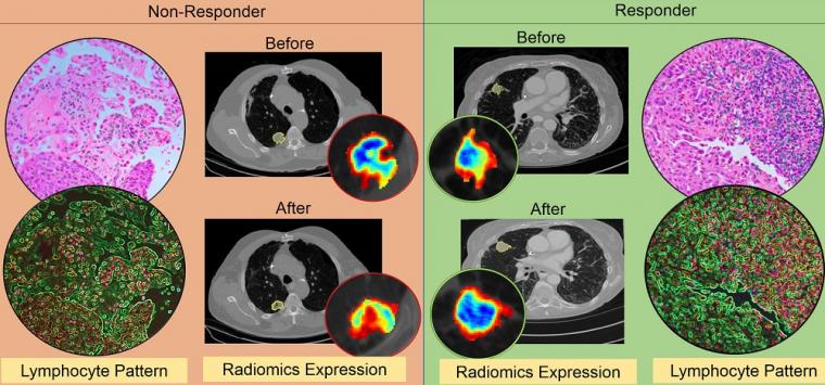 图中显示了…前后CT放射学模式的差异。