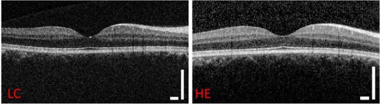 由新的低成本OCT系统拍摄的视网膜图像的比较(左)和…