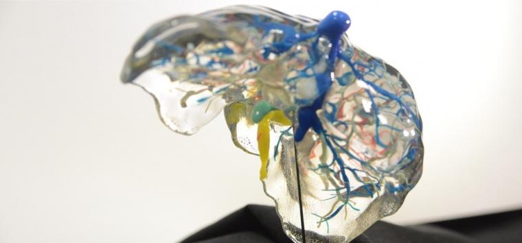 3D打印的肝脏模型。