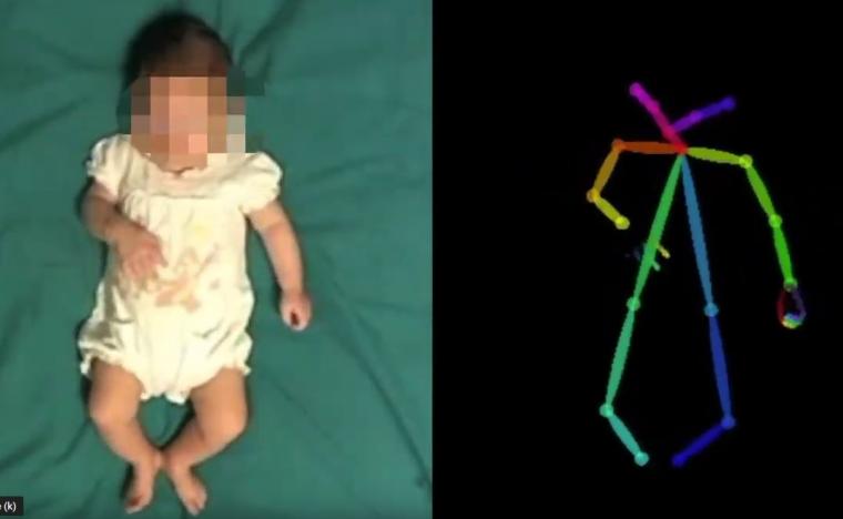 可以通过人工来分析躺在床上的婴儿的视频录制...