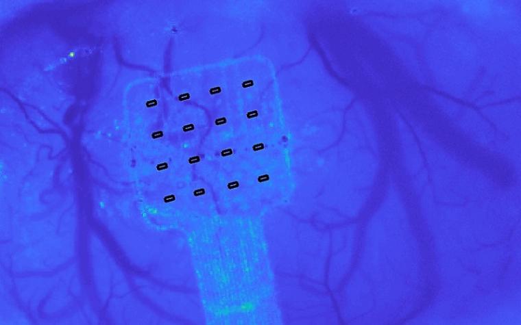 raphene旗舰研究人员开发了一种传感器，可以记录大脑活动在…