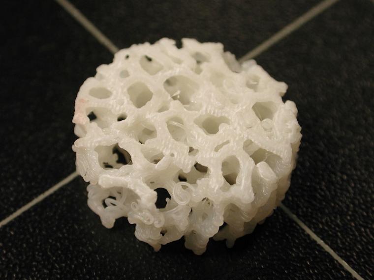 3D打印支架的特写，一个塑料骨骼形状的框架，将有助于…
