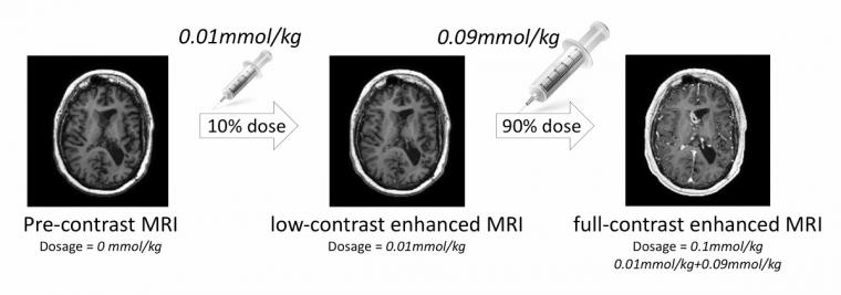 成像协议使用3个不同的MR系列在不同的对比剂量。