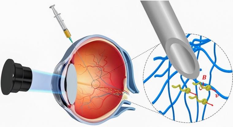 纳米机器人在进入视网膜的过程中被注入眼睛。