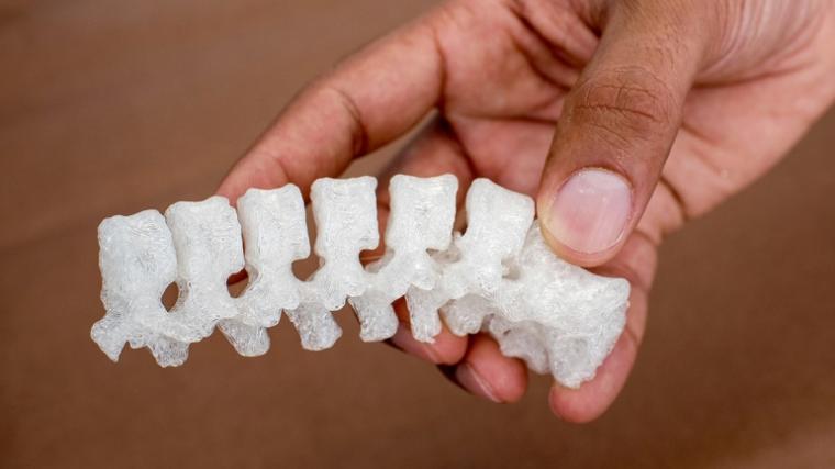 3D印刷脊柱是从患者的临床CT扫描中创建的......