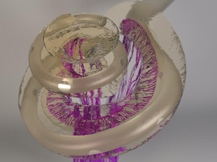 人工耳蜗植入电极植入人内耳的3D图像，…