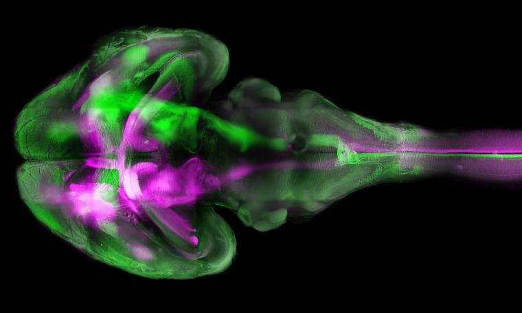小鼠的大脑——用荧光显微镜取，组织清除…