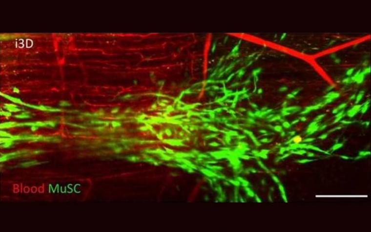 Blood vessels printed using using innovative technique dubbed ‘intravital 3D...