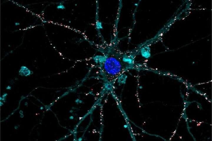 光活性纳米颗粒(红色)覆盖视网膜神经元膜(细胞核在…