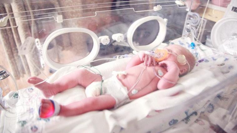 一个34周的早产儿在一个带氧气的隔离保温箱里。