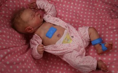 在发展中国家，安装在皮肤上的传感器监视着婴儿